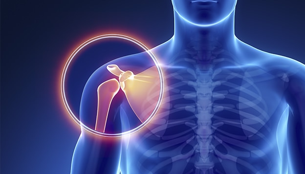 Can I Claim Compensation From My Employer for a Shoulder Injury Sustained at Work?